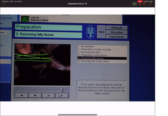 TP4-2024-video commentée du prélèvement  d'un nerf sciatique de grenouille.mp4